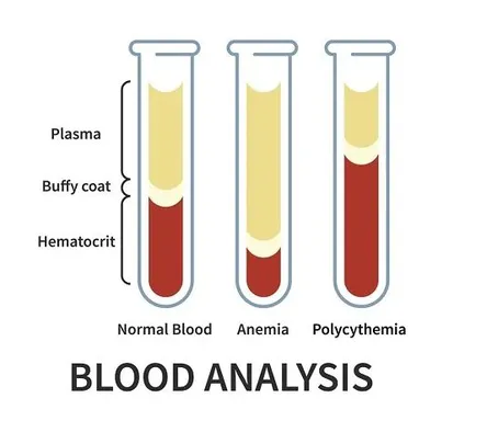 blood analysis