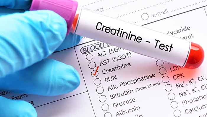 creatinine test