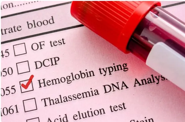 Hemoglobin Test