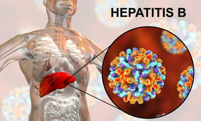 hepatitis b