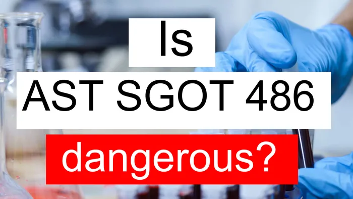 AST SGOT 486