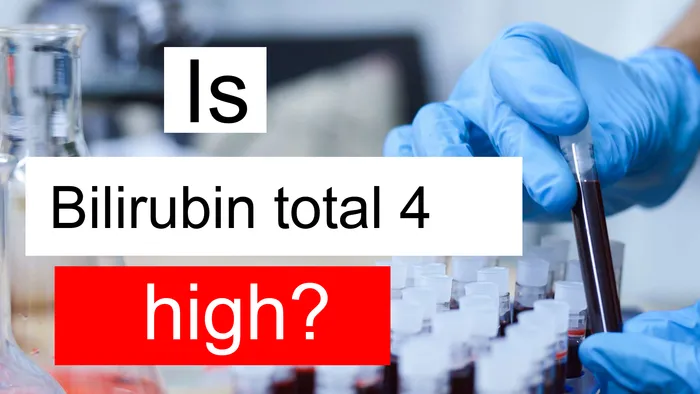 Bilirubin total 4