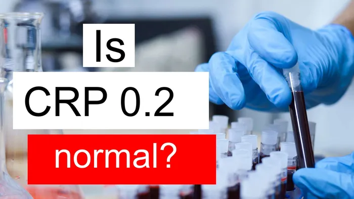 CRP 0.2