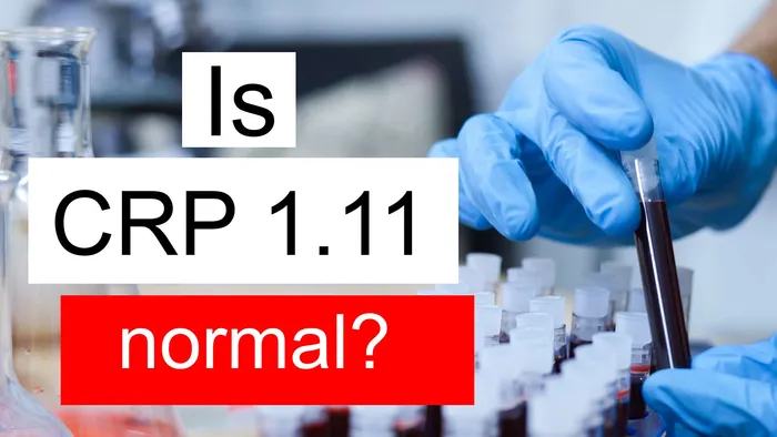 CRP 1.11