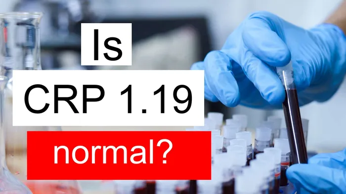 CRP 1.19