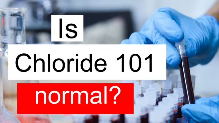 Chloride 101