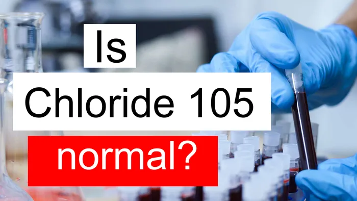 Chloride 105