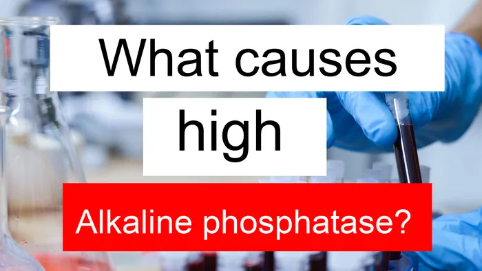 high Alkaline phosphatase