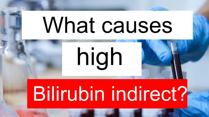 high Bilirubin indirect