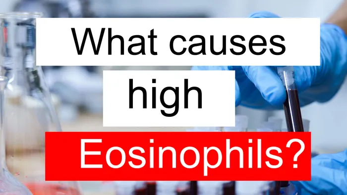 high Eosinophils