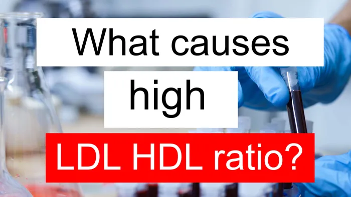 high LDL HDL ratio