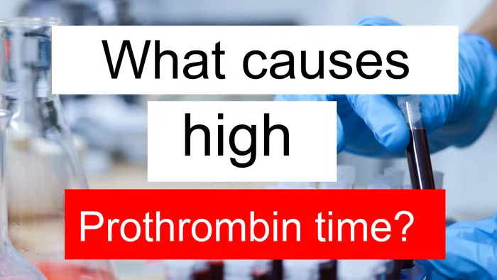 high Prothrombin time