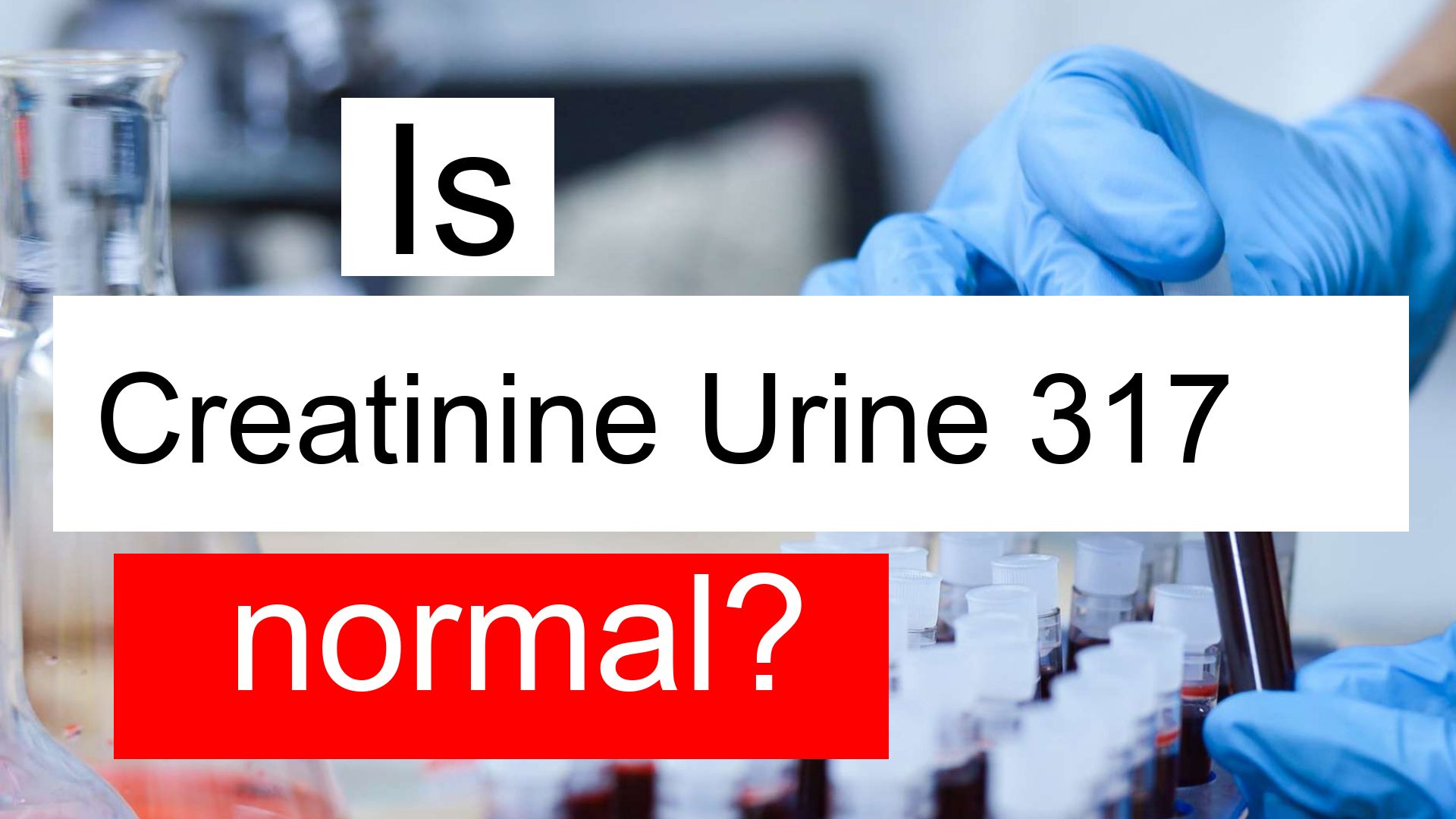 Is Creatinine Urine 317 Normal High Or Low What Does Creatinine Urine 