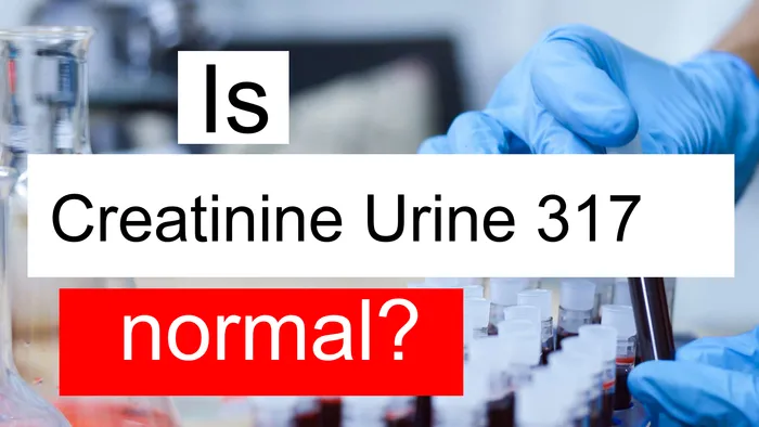 Creatinine Urine 317