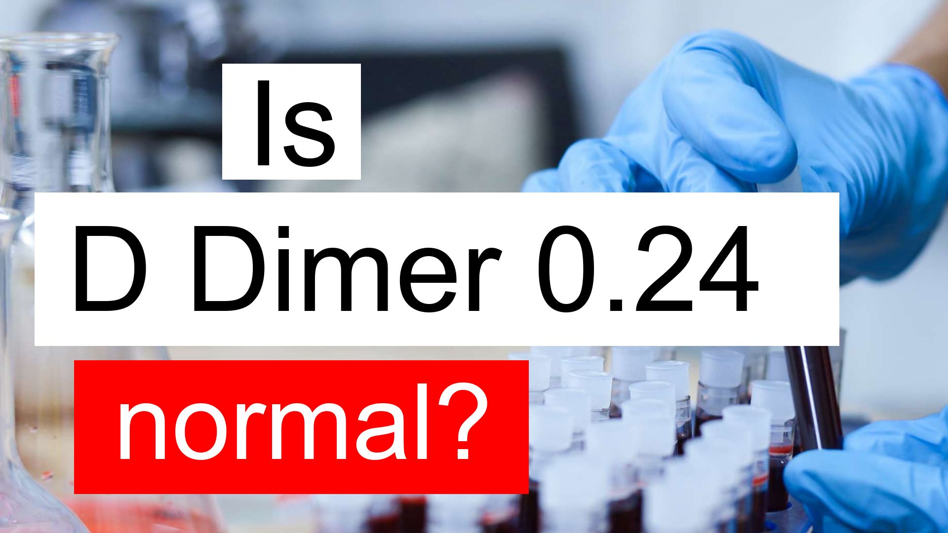 D Dimer 0.24 ug/mL: Symptoms you should not ignore