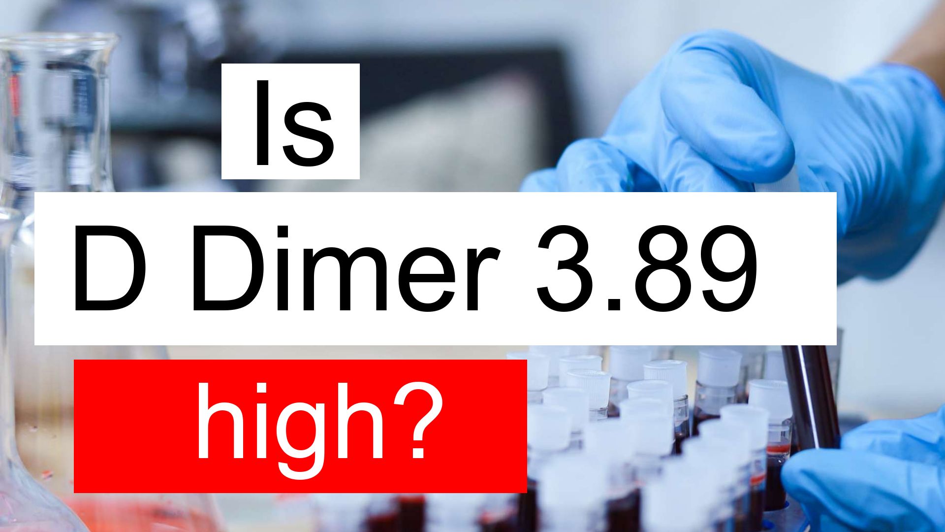 Is D Dimer 3.89 high, normal or dangerous? What does D Dimer level 3.89