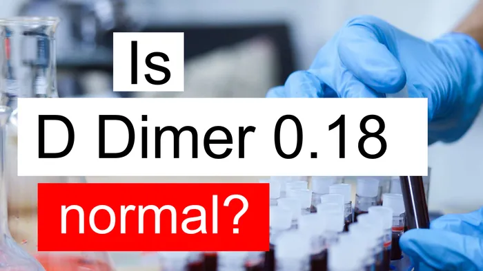 Is D Dimer 0.18 normal, high or low? What does D Dimer level 0.18 mean?