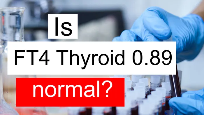 FT4 thyroid 0.89