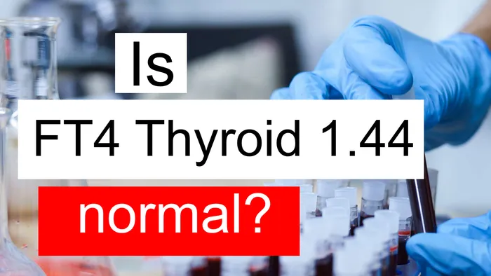 FT4 thyroid 1.44