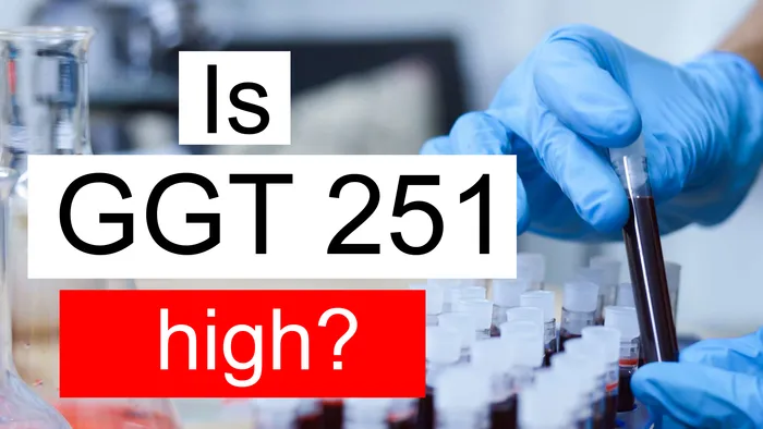 GGT 251