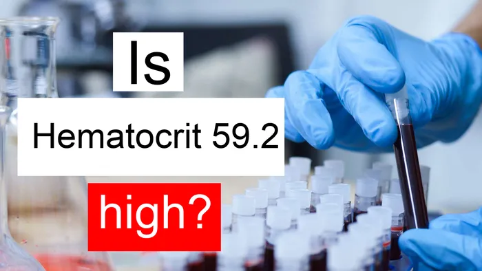 Hematocrit 59.2