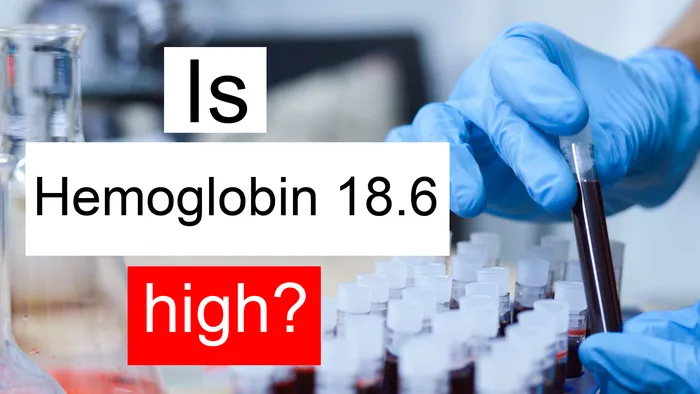 Hemoglobin 18.6