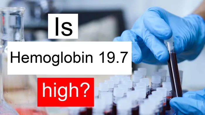 Hemoglobin 19.7