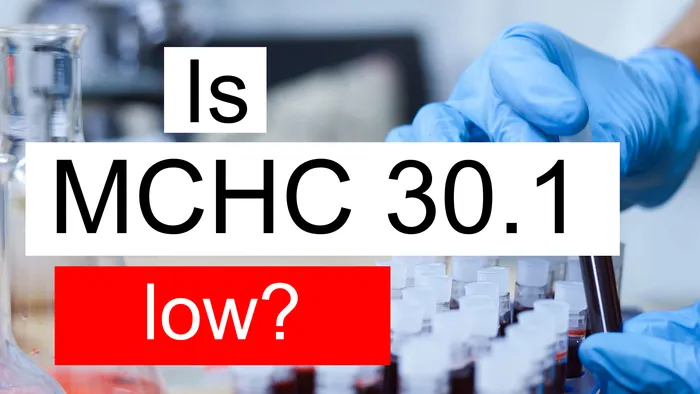 MCHC 30.1
