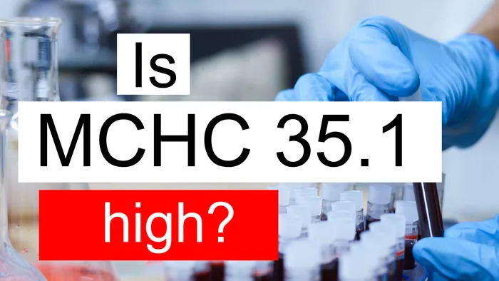 MCHC 35.1