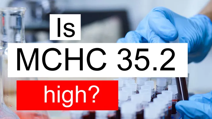 MCHC 35.2