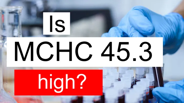 MCHC 45.3
