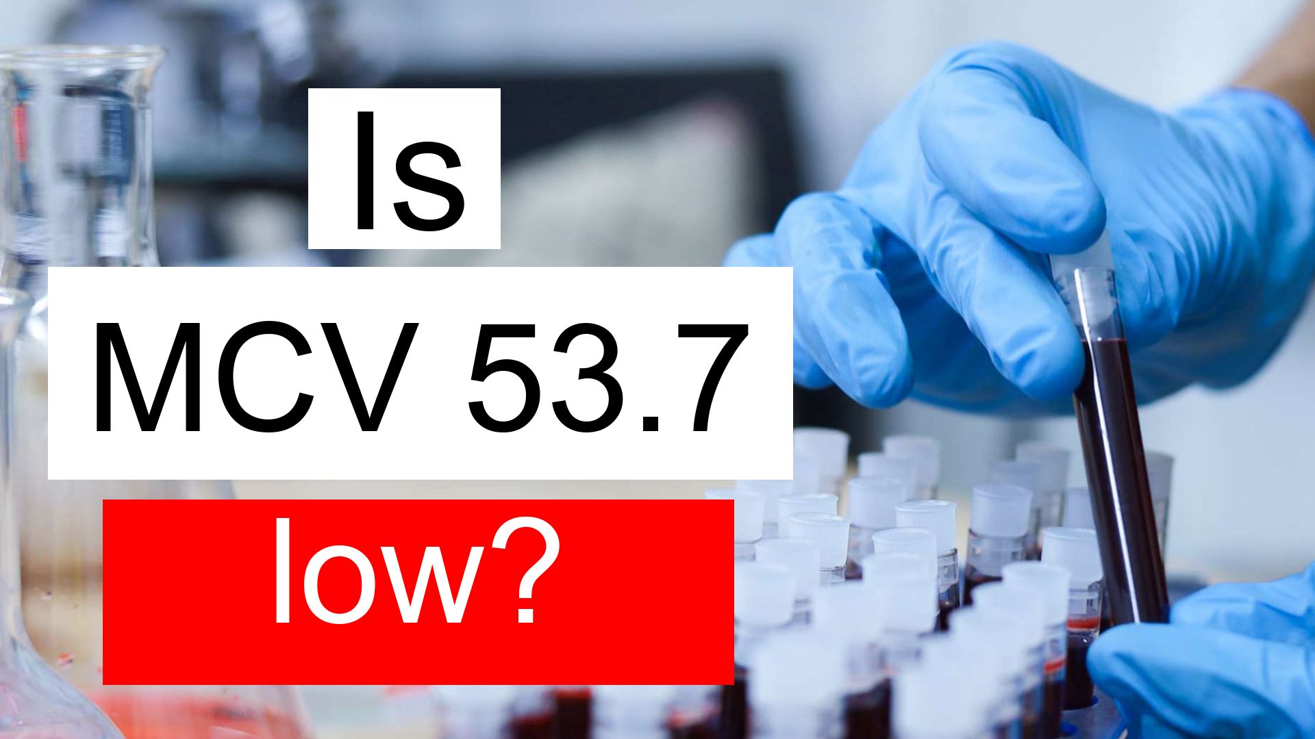 Mcv Value Means
