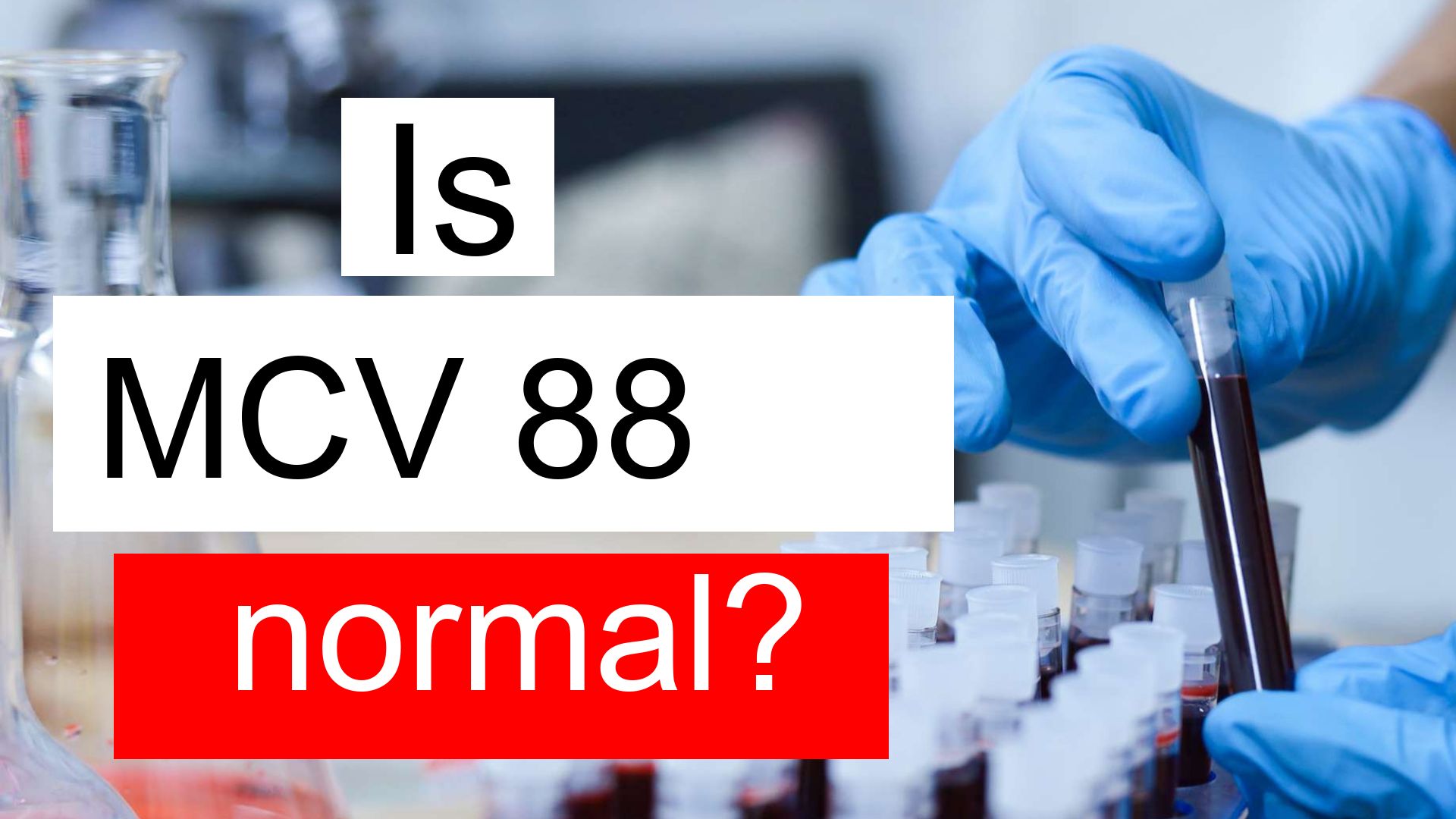 Is MCV 88 normal, high or low? What does Mean corpuscular volume level 88 mean?