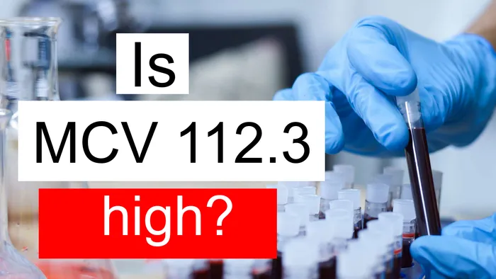 MCV 112.3