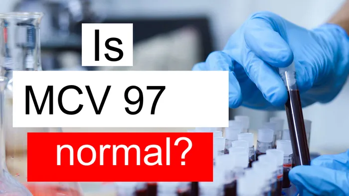 MCV 97