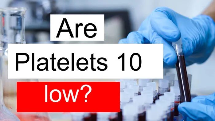 Platelet count 10