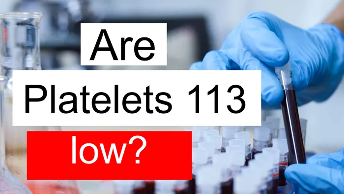 Platelet count 113