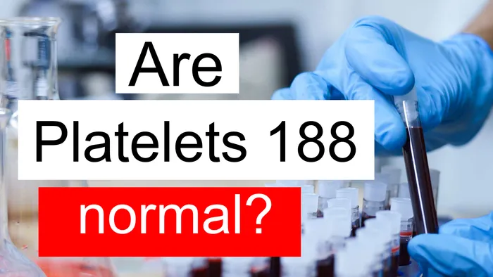 Platelet count 188