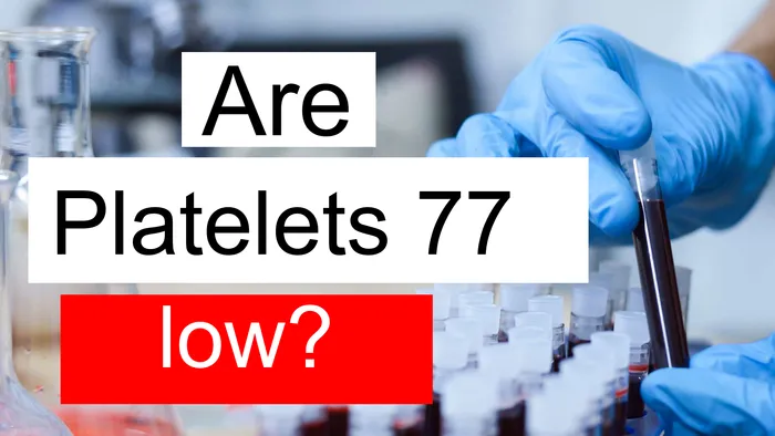 Platelet count 77