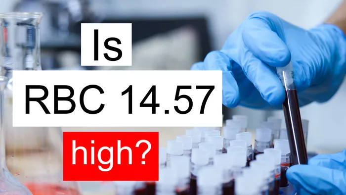 Aligator Rbc RBC 14.57 mil/uL: Symptoms you should not ignore | Red blood cell count