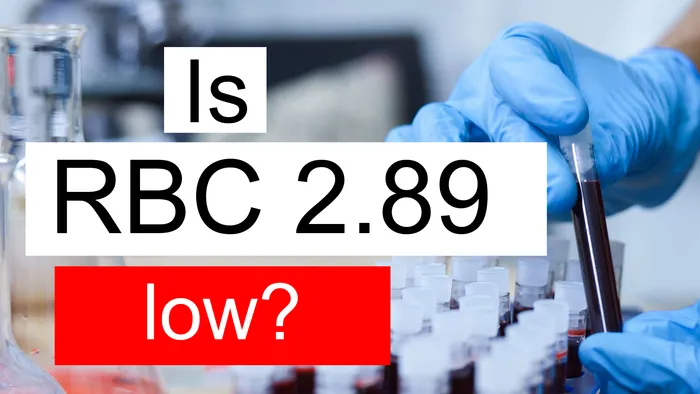 RBC 2.89