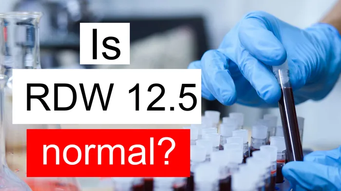 Important Rdw Is RDW 12.5 normal, high or low? What does Red cell distribution width ...