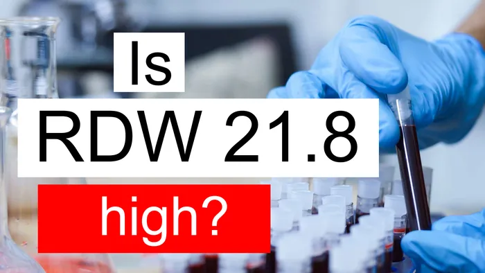 RDW 21.8