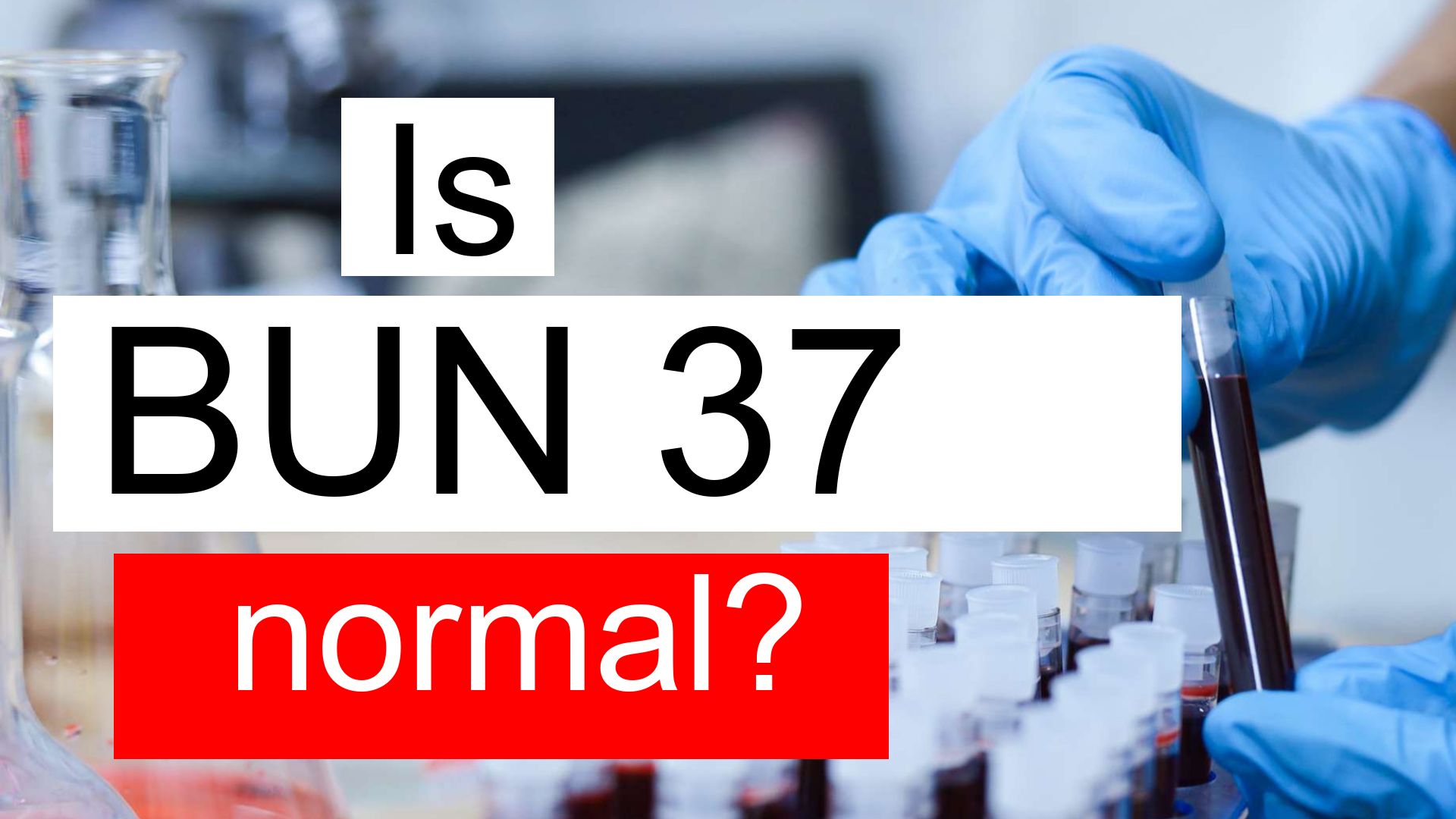 is-serum-bun-37-high-normal-or-dangerous-what-does-serum-bun-level-37