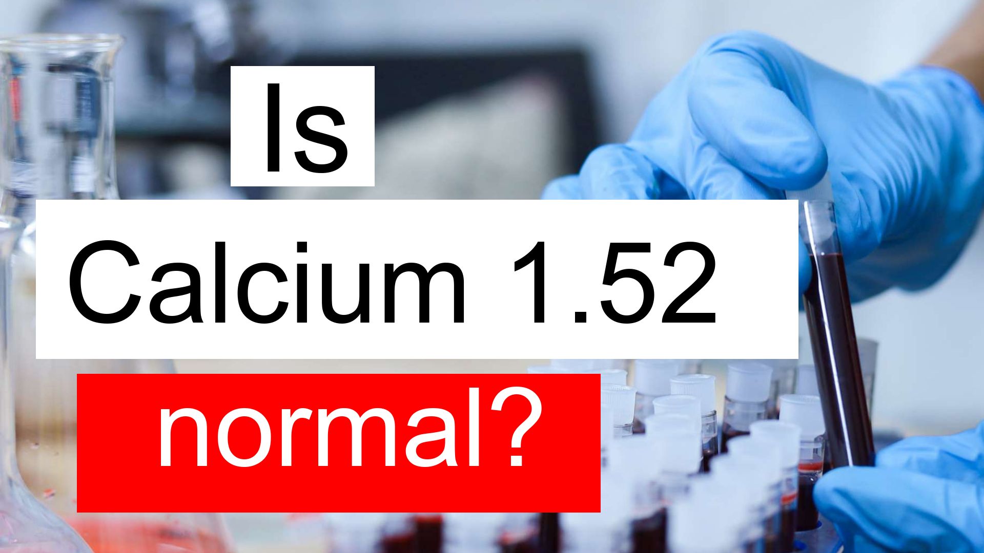 Is Serum Calcium 1.52 low, normal or dangerous? What does Serum Calcium