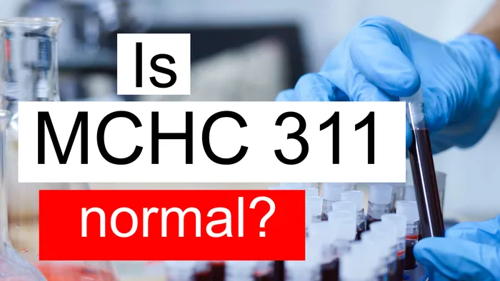 Serum MCHC 311