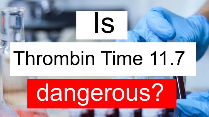 Thrombin Time 11.7