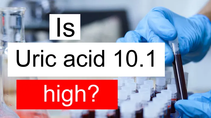 Uric acid 10.1