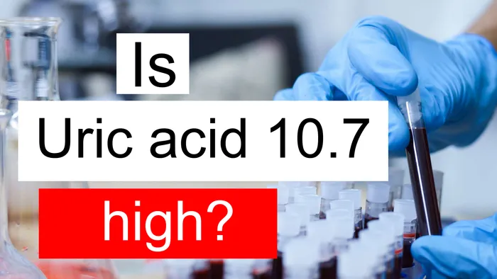 Uric acid 10.7