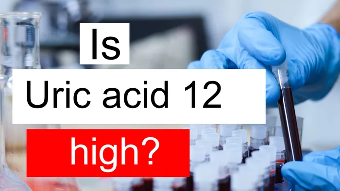 Uric acid 12